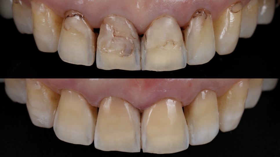 교대역 치과 소현수 원장의 강의 at 앞니치료연구회 관련 이미지 5