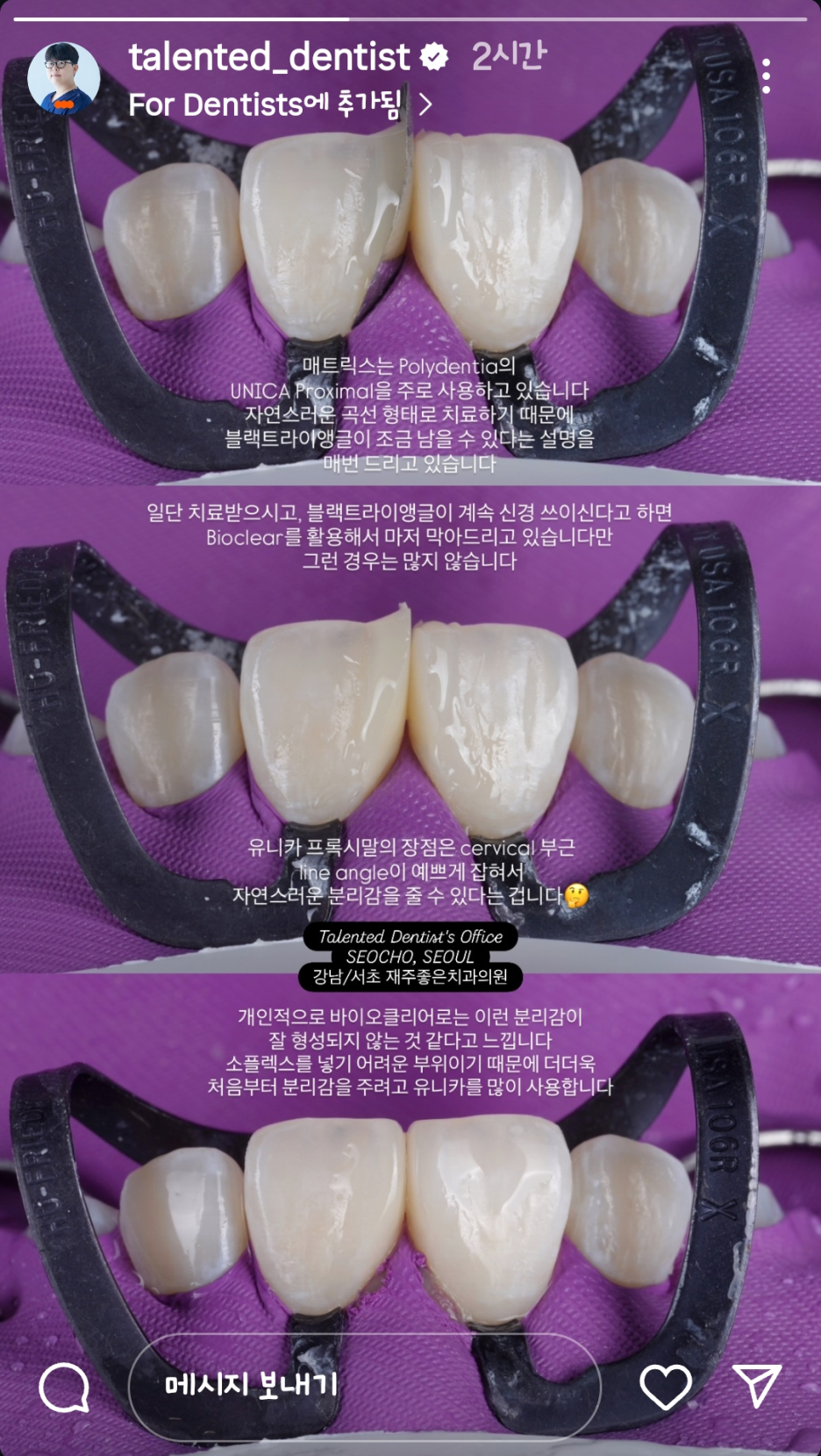 블랙트라이앵글 자연스럽게 메우는 비결은 이것 관련 이미지 1