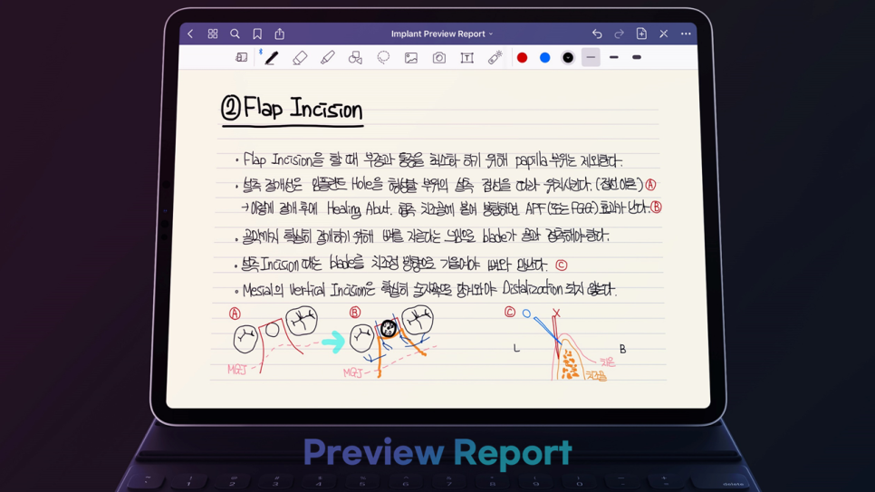 임플란트 라이브서저리 preview : 김영삼원장님 임플란트 강의 복습 관련 이미지 3