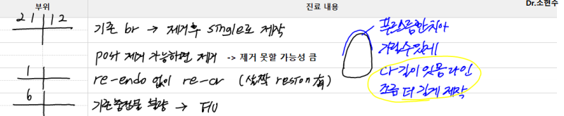 신논현치과 외국인 까만 앞니 크라운 교체 사례 관련 이미지 13