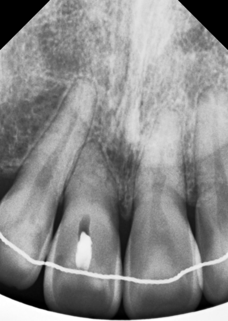 서초치과 5년간 14개 치과 돌다 본원에서 정착한 이유는? 관련 이미지 7