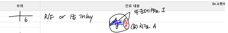 Jamnwon-dong Dental Clinic: Don’t Grind Down Your Teeth—Get Resin Build-up Instead image 5