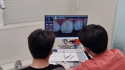 서초구치과 치아 사이 삭제 부작용과 치료법 관련 이미지 11