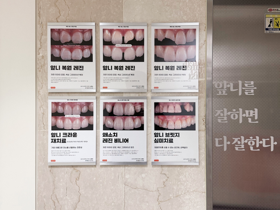 치과보존과 치아를 덜 깎는 치료를 지향하는 이유 관련 이미지 15