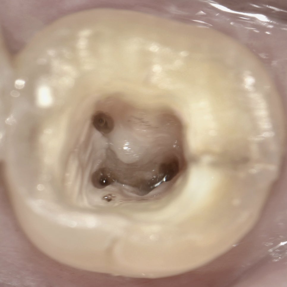 스무 번째 페닥 일기 관련 이미지 2