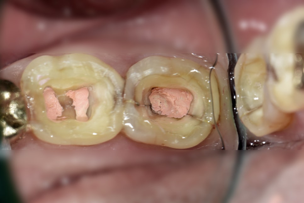 19주차 페닥일기 관련 이미지 1