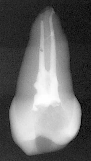 치과 공보의 일기 (4) : 또 실습 관련 이미지 2