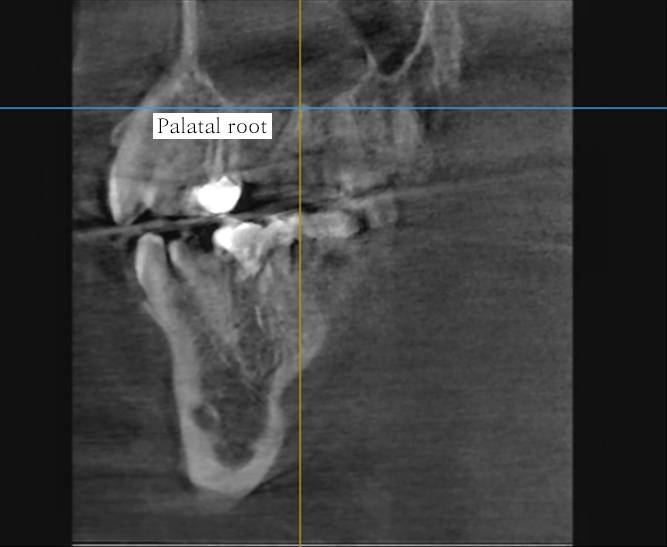 15주차 페닥 일기, 굳은살 관련 이미지 2