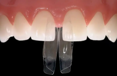 블랙트라이앵글 자연스럽게 메우는 비결은 이것 관련 이미지 2