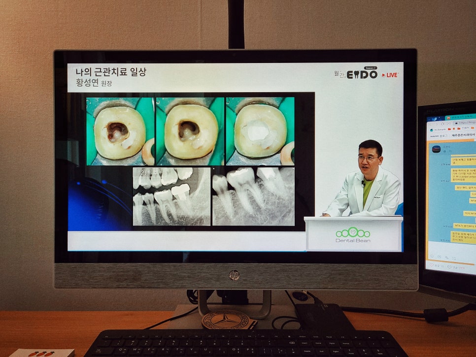 22년8월31일 / APEX 황성연원장님 월간엔도(덴탈빈) 관련 이미지 1