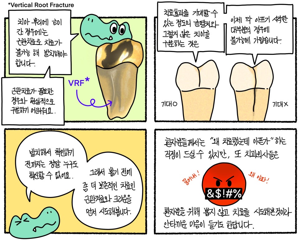 씹을 때 시큰한 통증! 금간 치아 크랙 신경치료와 발치 후 즉시 임플란트 이야기 관련 이미지 1