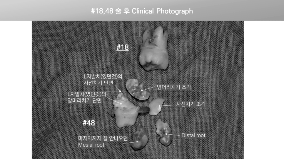 20년8월9일 / 김영삼원장님 라이브서저리 1회차 관련 이미지 3