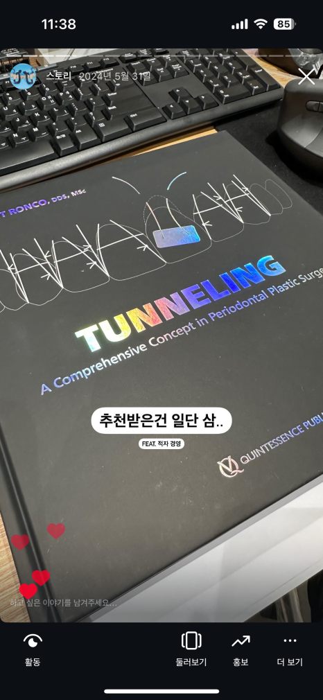 앞니 치료에 미쳐버린 치과의사 관련 이미지 5