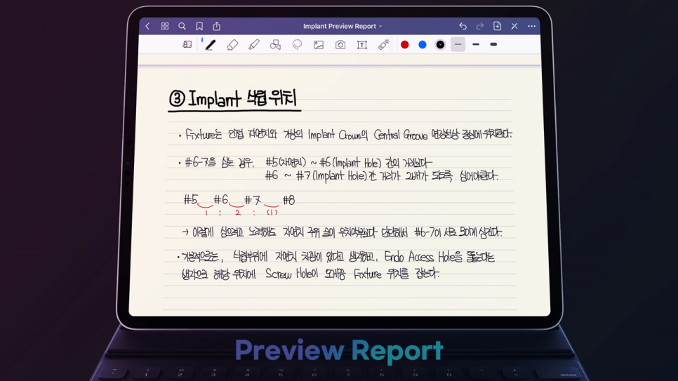 임플란트 라이브서저리 preview : 김영삼원장님 임플란트 강의 복습 관련 이미지 4