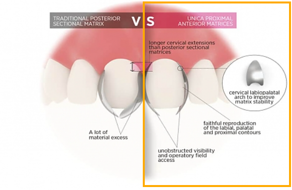 블랙트라이앵글 자연스럽게 메우는 비결은 이것 관련 이미지 5