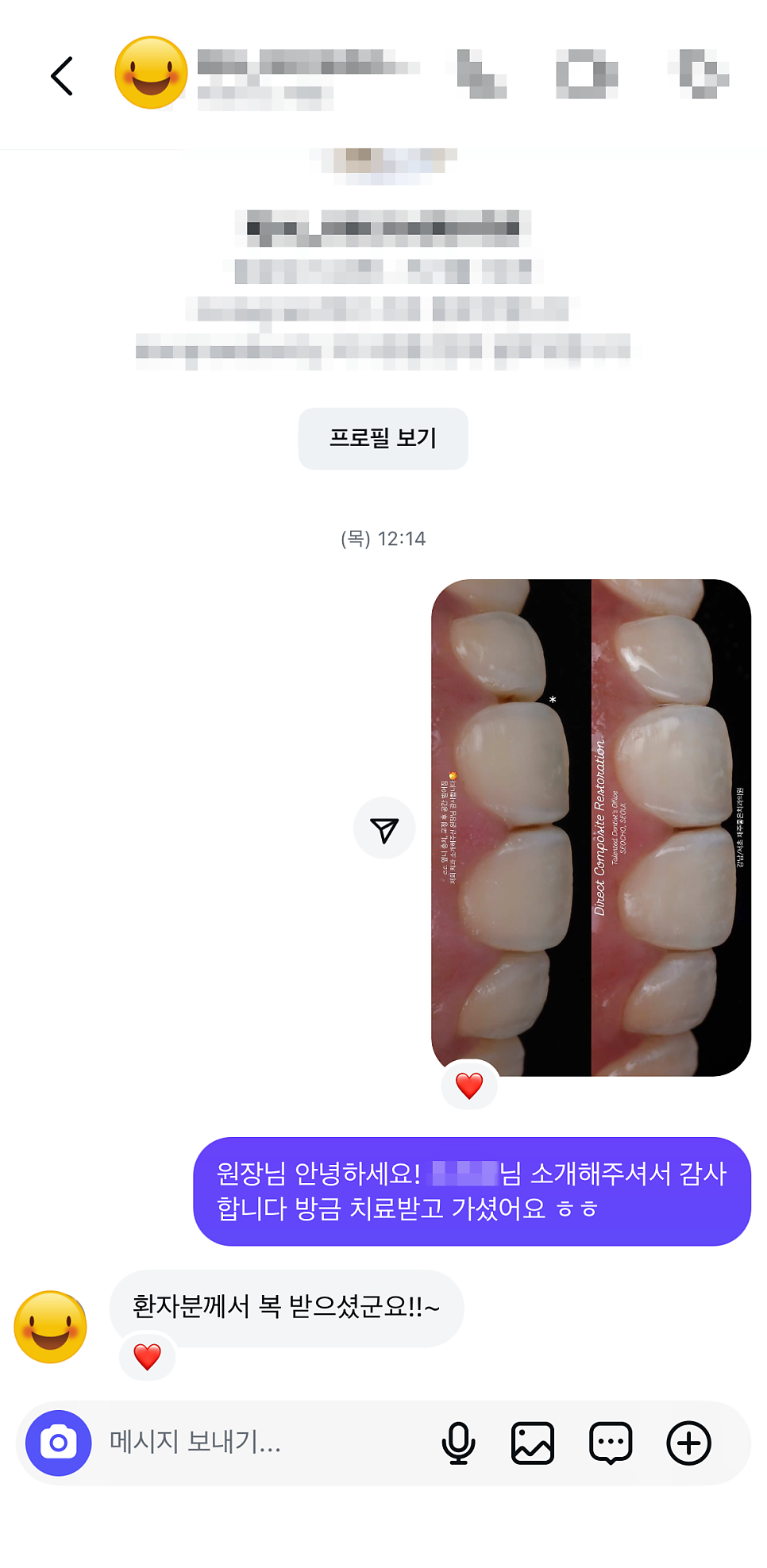 서초구치과 치아 사이 삭제 부작용과 치료법 관련 이미지 1