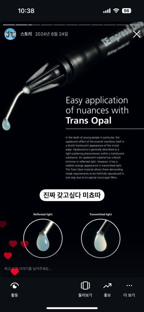 앞니 치료에 미쳐버린 치과의사 관련 이미지 1