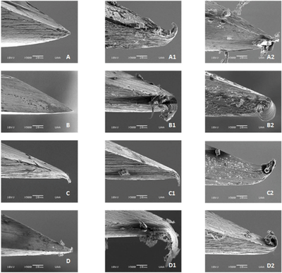 치과 공보의 일기 (30) : 국소마취 시 통증경감법(무통마취) 관련 이미지 1
