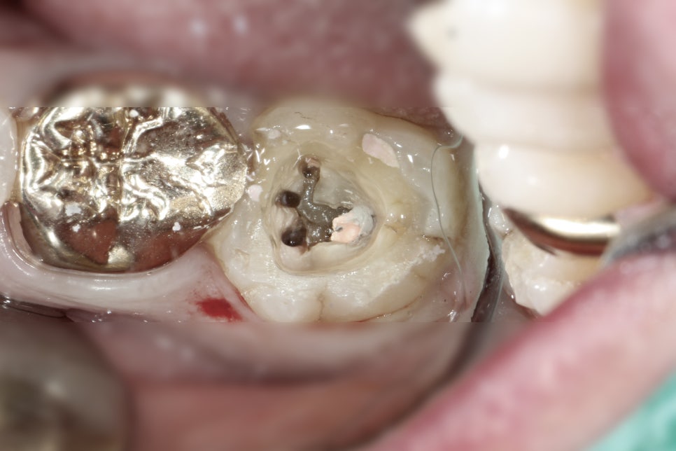 19주차 페닥일기 관련 이미지 2