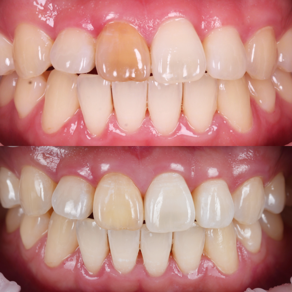 서초치과 5년간 14개 치과 돌다 본원에서 정착한 이유는? 관련 이미지 9