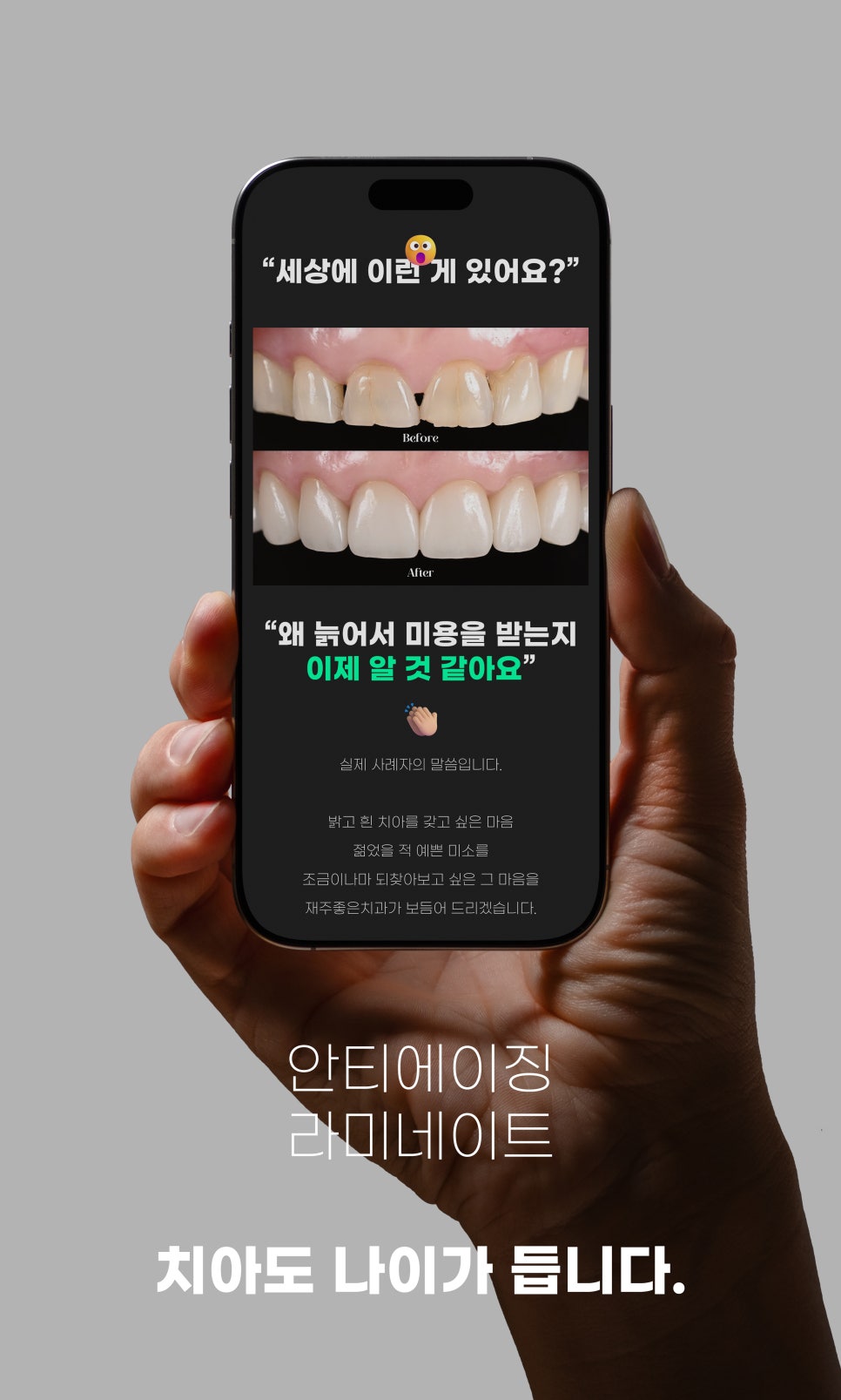 앞니 실금, 부모님 나이 든 치아 라미네이트 건강선물 관련 이미지 3