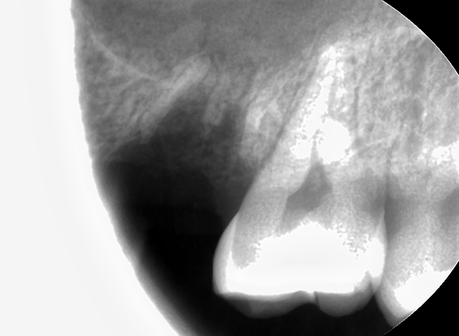 15주차 페닥 일기, 굳은살 관련 이미지 3