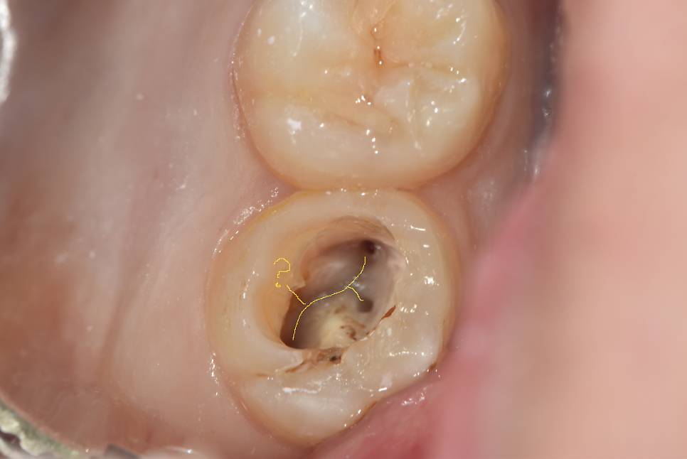치과 페이닥터 3개월째 근무 일기 long ver. 관련 이미지 2