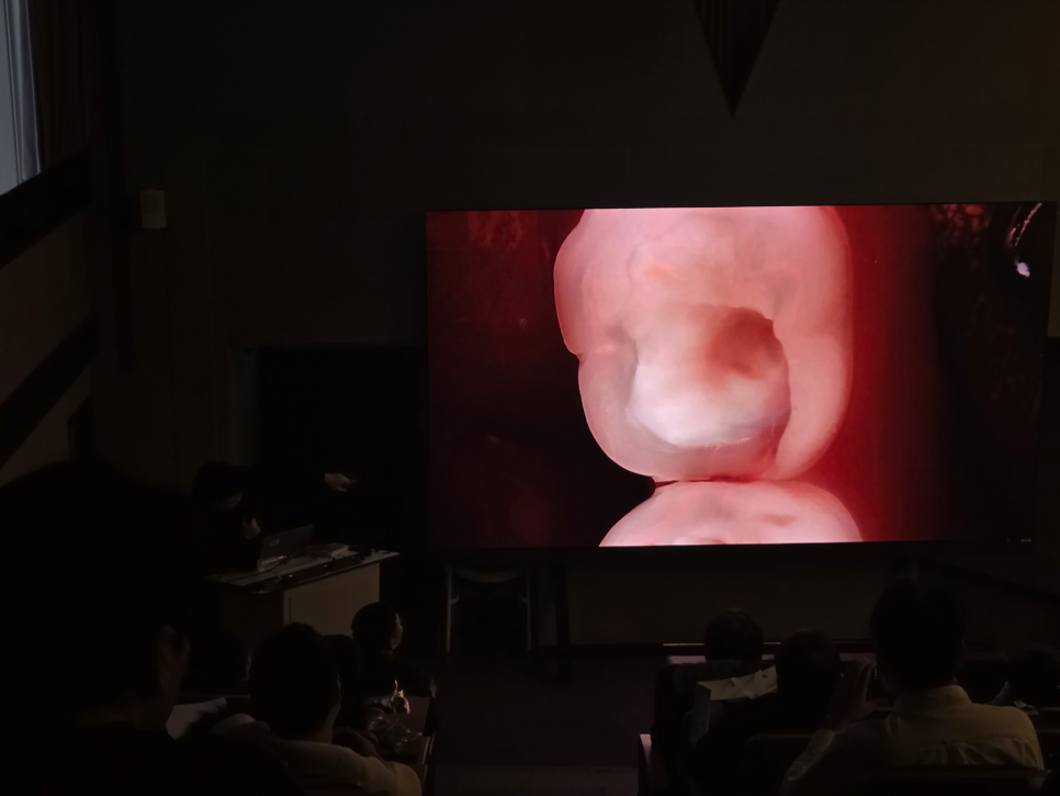 치과의사 대상으로 앞니 레진 빌드업 강의하고 왔습니다 관련 이미지 9