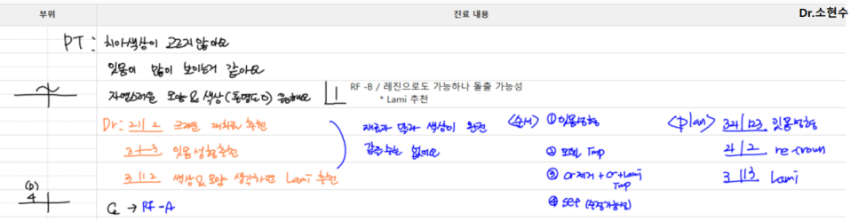 라미네이트, 크라운 재치료, 잇몸 성형까지 앞니 6개 치료 관련 이미지 7