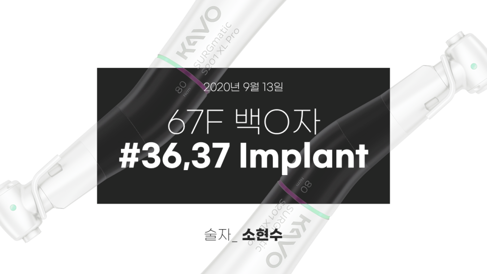 임플란트 라이브서저리 preview : 김영삼원장님 임플란트 강의 복습 관련 이미지 1
