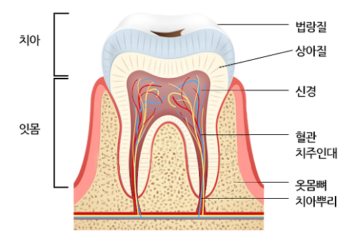 신논현역치과 심하게 마모된 60대 남성 앞니 크라운 치료 관련 이미지 2
