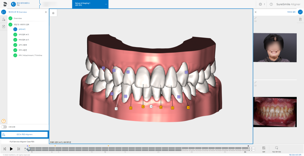 치아 교정 양치질, 아이에게 이 글을 공유해주세요. 관련 이미지 3