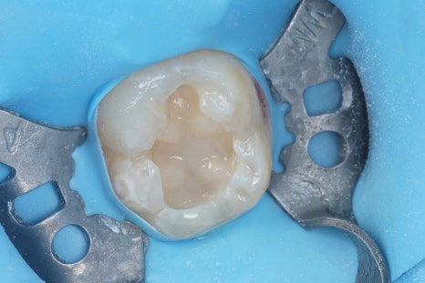Aesthetic Dentistry Practice Opening Story 3 image 1