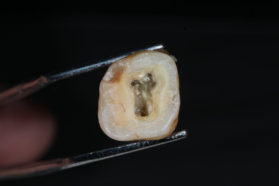 22년5월22일 / Troubleshooting Symposium, 조용식원장님 AO intensive course 관련 이미지 2