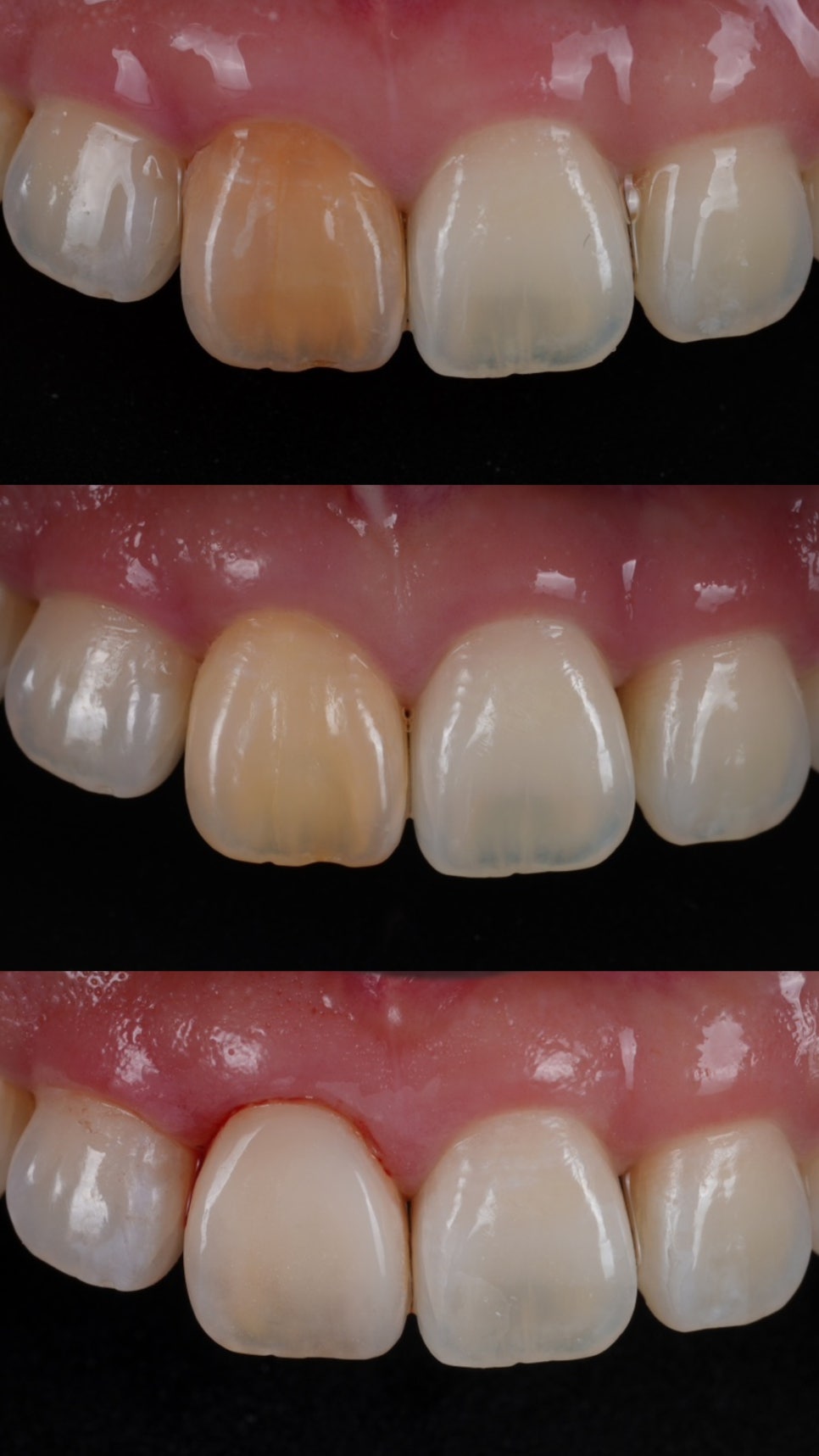 서초치과 5년간 14개 치과 돌다 본원에서 정착한 이유는? 관련 이미지 12