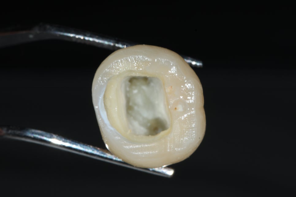 22년5월22일 / Troubleshooting Symposium, 조용식원장님 AO intensive course 관련 이미지 3