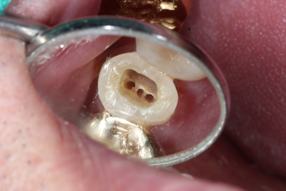 22주차 1기 관련 이미지 1