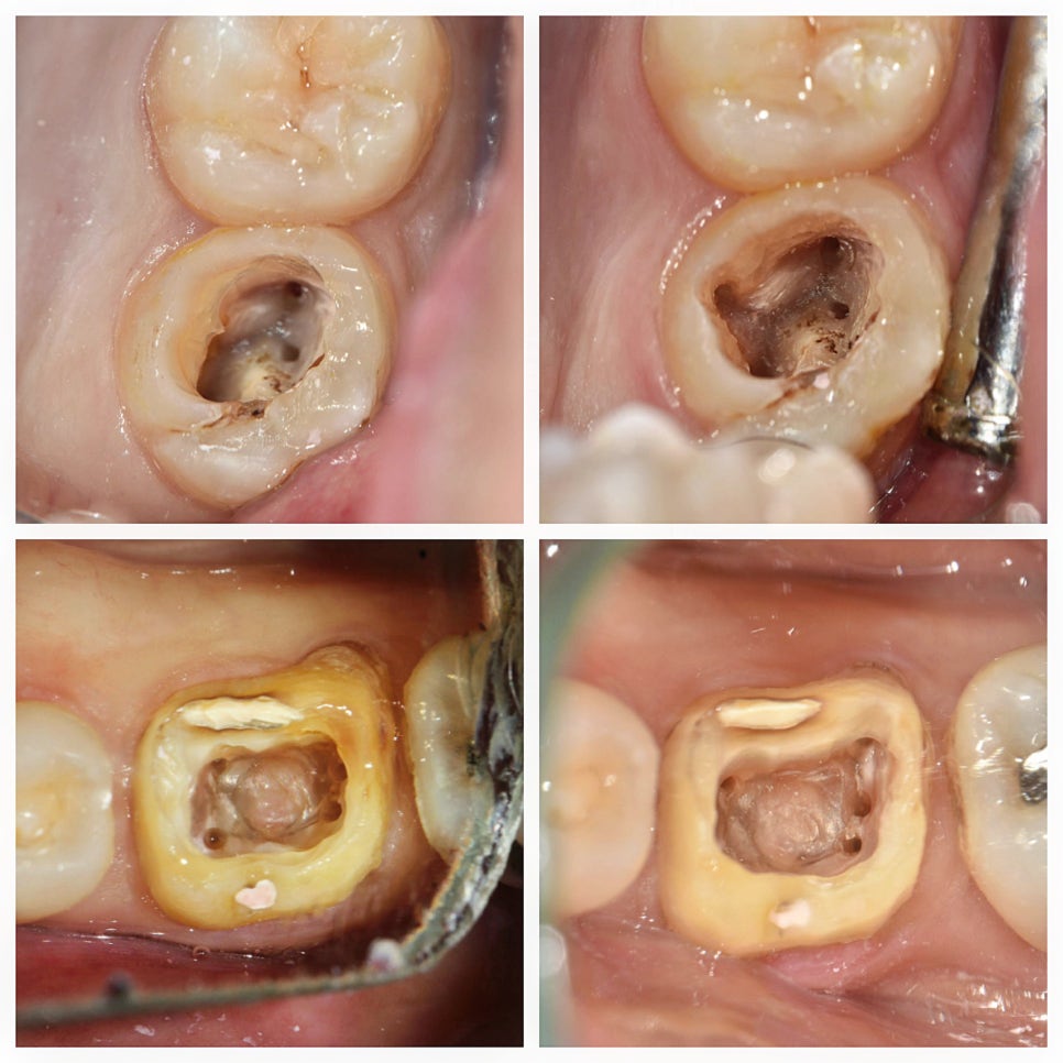 치과 페이닥터 3개월째 근무 일기 long ver. 관련 이미지 1