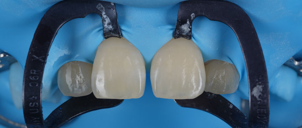 양재역치과 앞니 레진 받으러 수원에서 오신 이유(feat. 치과의사 소개) 관련 이미지 6