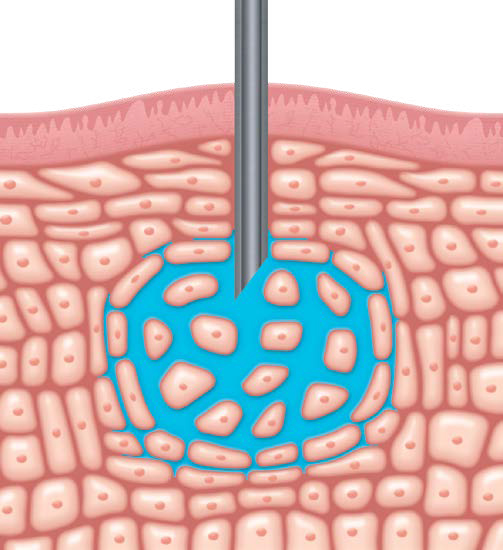 치과 마취 주사가 무서워요!! 관련 이미지 2