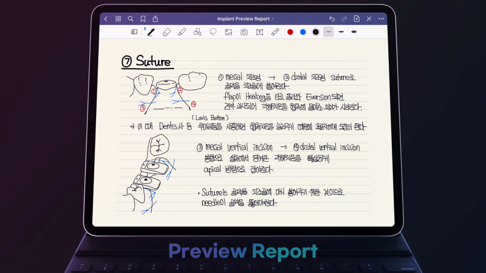 임플란트 라이브서저리 preview : 김영삼원장님 임플란트 강의 복습 관련 이미지 8