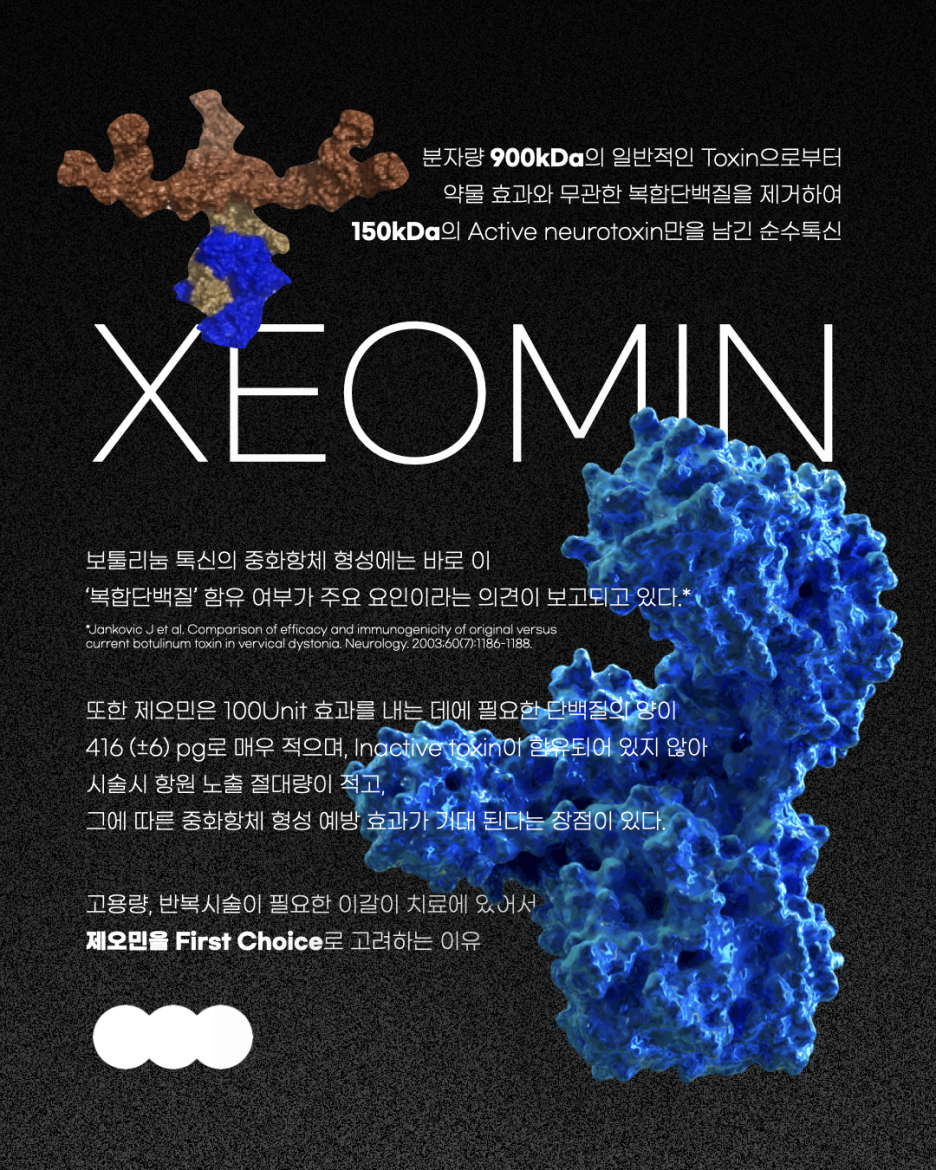 이갈이 장치 보톡스랑 함께 하면 훨씬 좋은 이유 관련 이미지 7