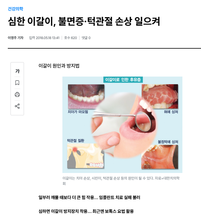 이갈이 장치 보톡스랑 함께 하면 훨씬 좋은 이유 관련 이미지 1