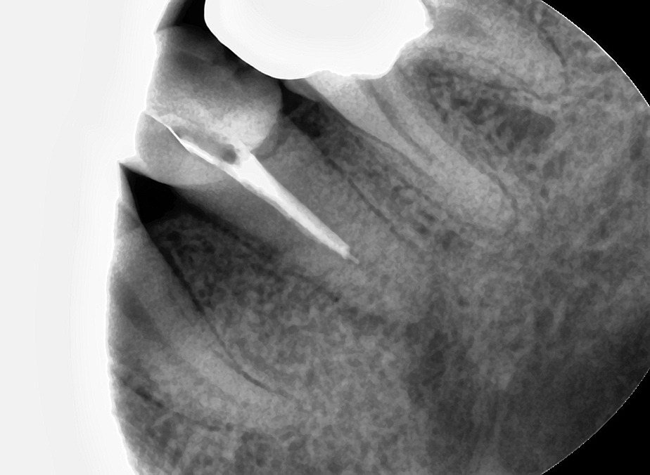 치과 페이닥터 3개월째 근무 일기 long ver. 관련 이미지 5