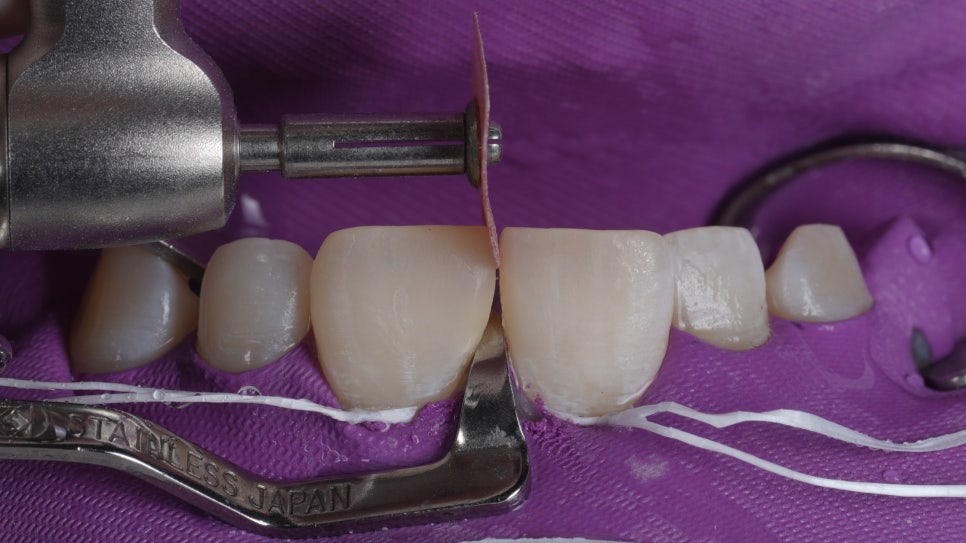 블랙트라이앵글 자연스럽게 메우는 비결은 이것 관련 이미지 9