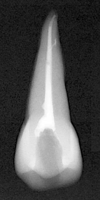 치과 공보의 일기 (4) : 또 실습 관련 이미지 1