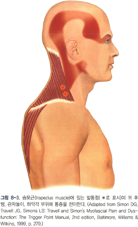턱이 아픈데 어깨를 치료하라고요? 관련 이미지 2