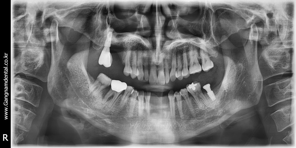 20년11월29일 / 김영삼원장님 라이브서저리 4회차 관련 이미지 3