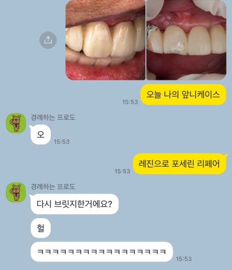 앞니 임플란트 PFM 보철 도자기 깨짐, 당일 수리해주는 서초 치과 관련 이미지 4