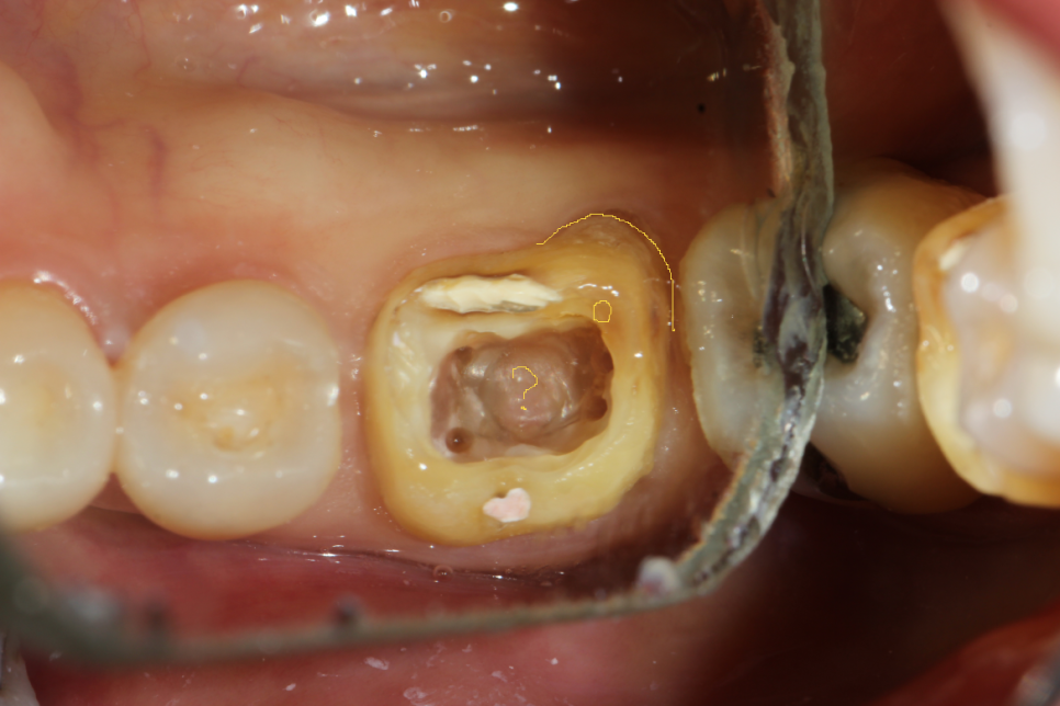 치과 페이닥터 3개월째 근무 일기 long ver. 관련 이미지 3
